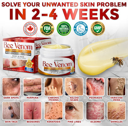GFOUK® Bee Venom Comprehensive Repair Mcroneedle Cream 🇨🇦 Made in Canada ❤️