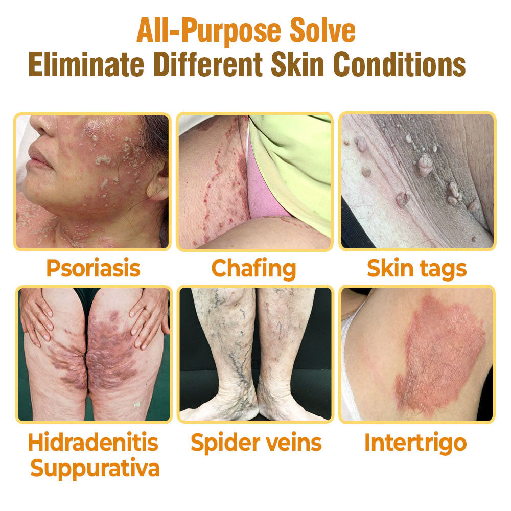 flysmus® Bee Venom Comprehensive Cream