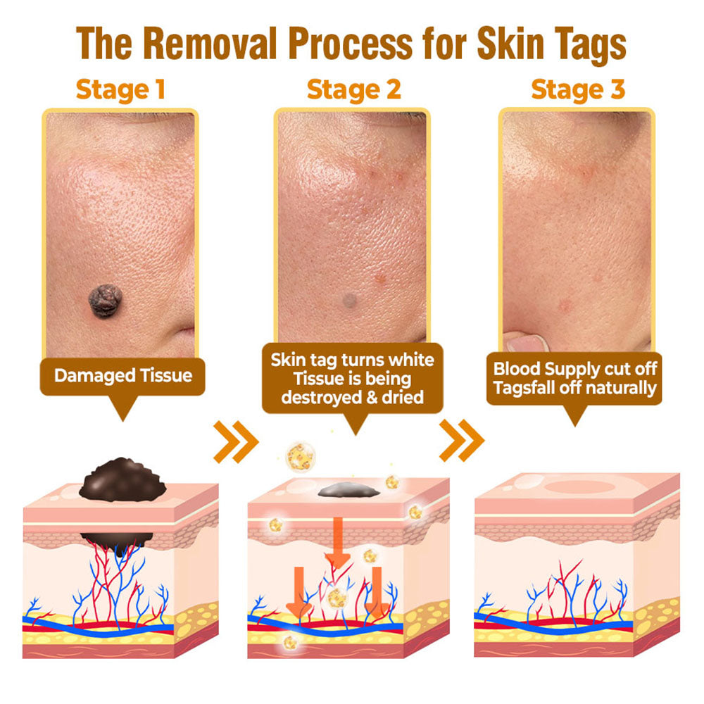 flysmus® Bee Venom Comprehensive Cream