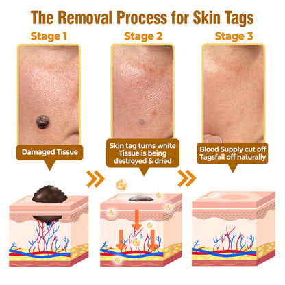 flysmus® Bee Venom Comprehensive Cream