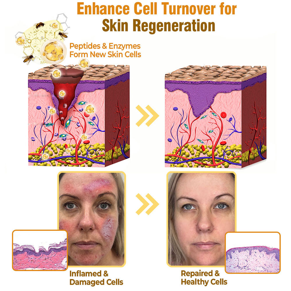 flysmus® Bee Venom Comprehensive Cream