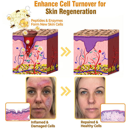 flysmus® Bee Venom Comprehensive Cream