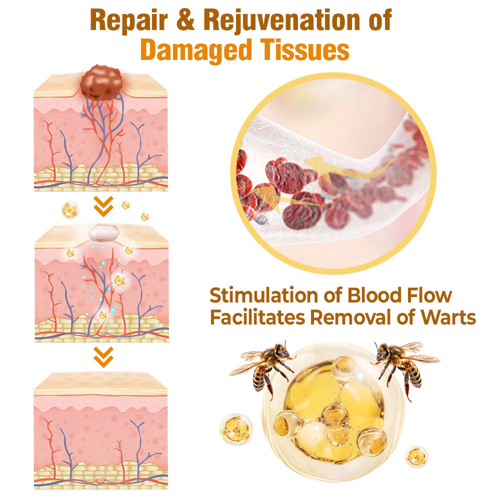 flysmus® Bee Venom Comprehensive Cream