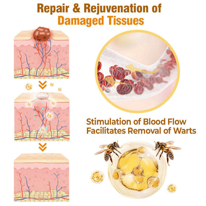 flysmus® Bee Venom Comprehensive Cream