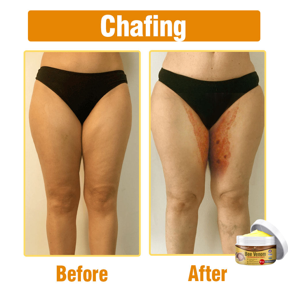 flysmus® Bee Venom Comprehensive Cream