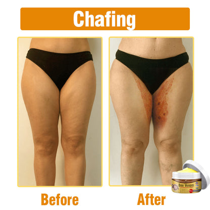 flysmus® Bee Venom Comprehensive Cream