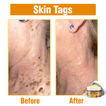 flysmus® Bee Venom Comprehensive Cream