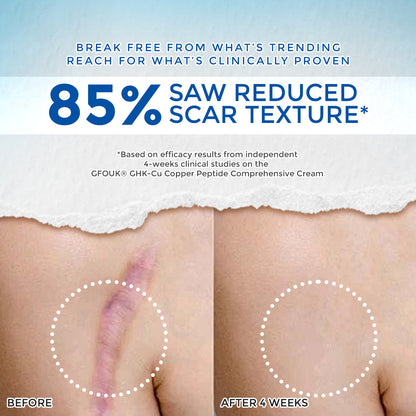 GFOUK® GHK-Cu Copper Peptide Comprehensive Cream 🇨🇦 Made in Canada (for Itching Skin, Redness, Eczema, Hyperpigmentation, Scar Reduction etc)