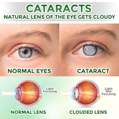 GFOUK® OptiFusion Nano Eye Drops Serum 🇨🇦🩺 Doctor Recommended (for Presbyopia, Cataracts, Glaucoma, Dry Eyes)