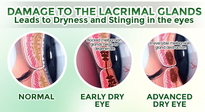 GFOUK® OptiFusion Nano Eye Drops Serum 🇨🇦🩺 Doctor Recommended (for Presbyopia, Cataracts, Glaucoma, Dry Eyes)