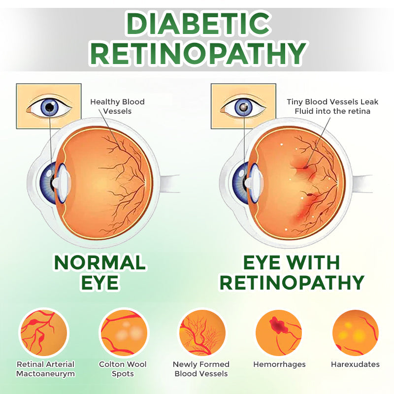 GFOUK® OptiFusion Nano Eye Drops Serum 🇨🇦🩺 Doctor Recommended (for Presbyopia, Cataracts, Glaucoma, Dry Eyes)