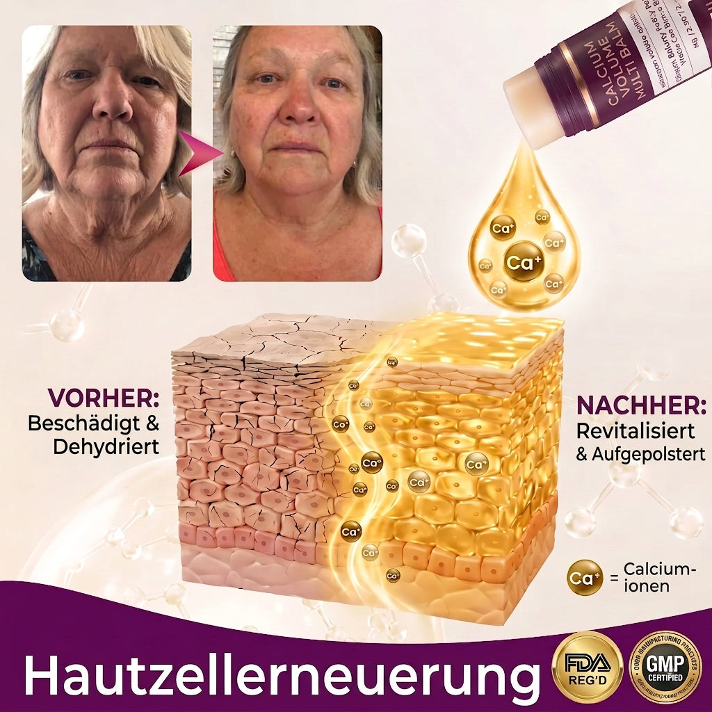 Hudros® Calcium Volumen Botox Balsam