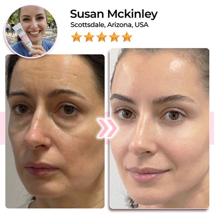 Momokee® PDRN Eyes & Body Multi-Cream