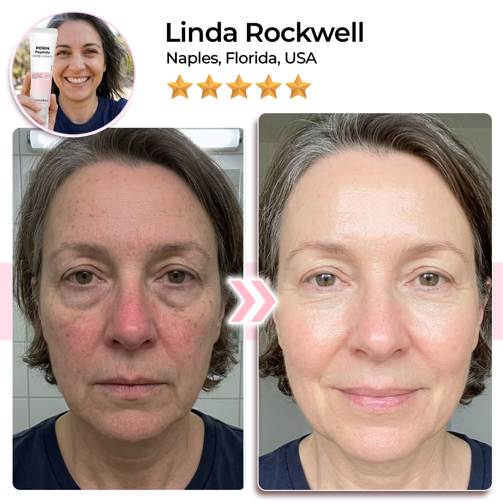 Momokee® PDRN Eyes & Body Multi-Cream
