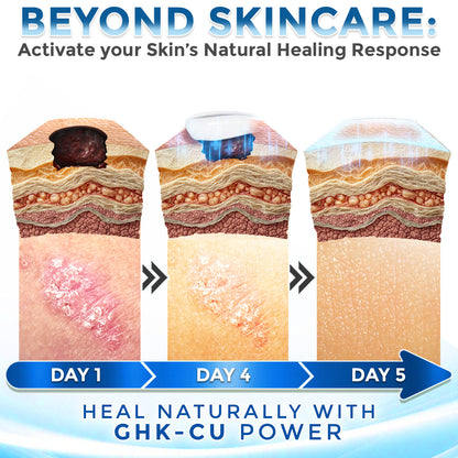 GFOUK® GHK-Cu Copper Peptide Comprehensive Cream 🇨🇦 Made in Canada (for Itching Skin, Redness, Eczema, Hyperpigmentation, Scar Reduction etc)