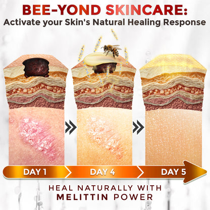 GFOUK® Bee Venom Comprehensive Repair Mcroneedle Cream 🇨🇦 Made in Canada ❤️