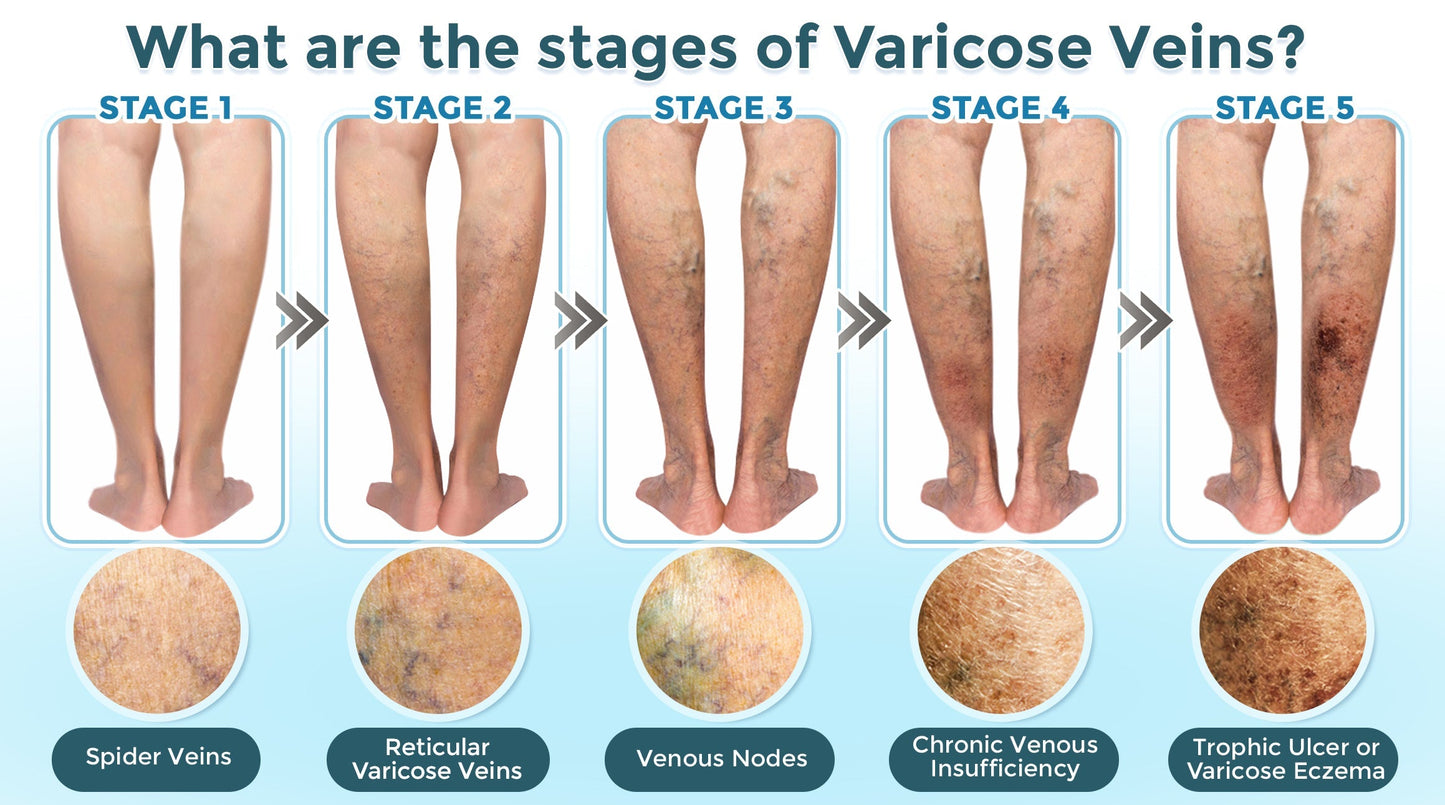 GFOUK® VenaRestore MicroNeedle Vein Repair Patch 🇨🇦