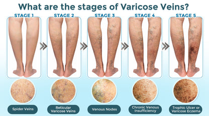 GFOUK® VenaRestore MicroNeedle Vein Repair Patch 🇨🇦